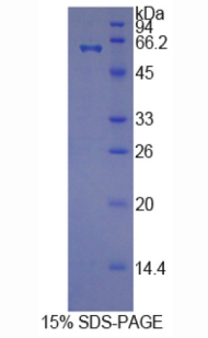 Recombinant Histidine Rich Glycoprotein (HRG)