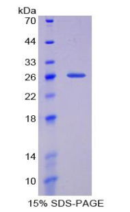 Recombinant Histidine Rich Glycoprotein (HRG)