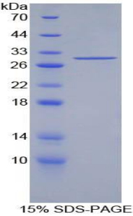 Recombinant Insulin Receptor Substrate 1 (IRS1)