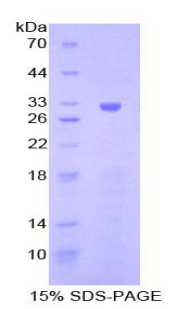 Recombinant Janus Kinase 1 (JAK1)