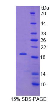 RPC559Hu01.jpg