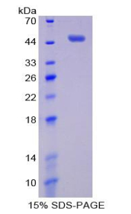 Recombinant Pim-1 Oncogene (PIM1)