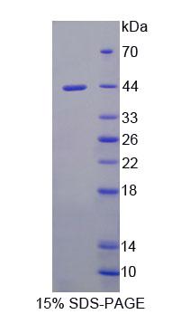 Recombinant Ubiquinol Cytochrome C Reductase Binding Protein (UQCRB)