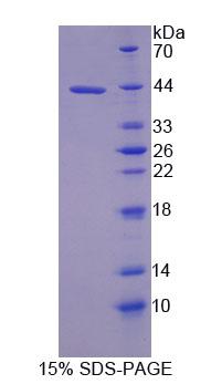 Recombinant Ubiquinol Cytochrome C Reductase Binding Protein (UQCRB)