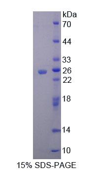 Recombinant Metaxin 1 (MTX1)