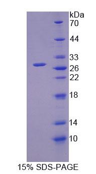 Recombinant Oligophrenin 1 (OPHN1)