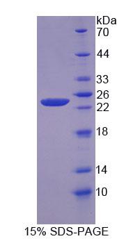 Recombinant Anoctamin 2 (ANO2)