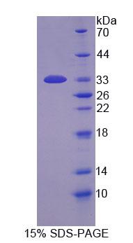 Recombinant Peptidyl Arginine Deiminase Type I (PADI1)