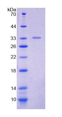 Recombinant Polymerase DNA Directed Alpha 1 (POLa1)