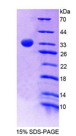 Recombinant Pyridoxamine-5'-Phosphate Oxidase (PNPO)