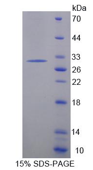 Recombinant Pituitary Tumor Transforming 1 (PTTG1)