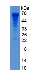 Recombinant Ryanodine Receptor 1, Skeletal (RYR1)