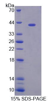 Recombinant Tissue Specific Transplantation Antigen P35B (TSTA3)