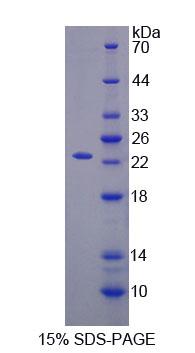 Recombinant Sciellin (SCEL)