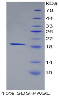 Recombinant Renalase (RNLS)