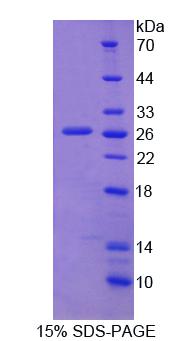 Recombinant Signal Recognition Particle Receptor B (SRPRB)