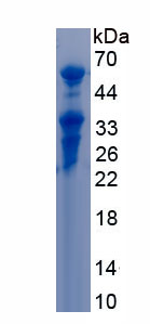 Recombinant Stabilin 1 (STAB1)