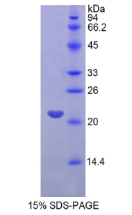 Recombinant Fibroblast Growth Factor 13 (FGF13)