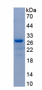 Recombinant Fibroblast Growth Factor 21 (FGF21)