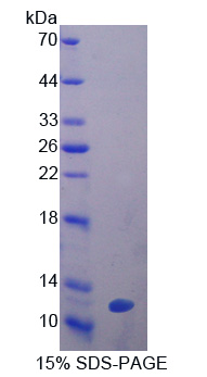 Recombinant Glutathione Peroxidase 3, Plasma (GPX3)