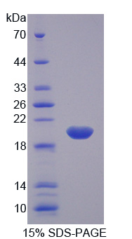 RPC997Hu01.jpg