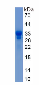 Recombinant Follicle Stimulating Hormone Beta (FSHb)