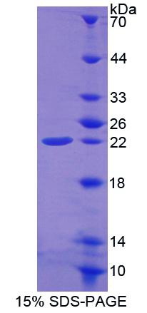 Recombinant Ferritin, Heavy Polypeptide (FTH)