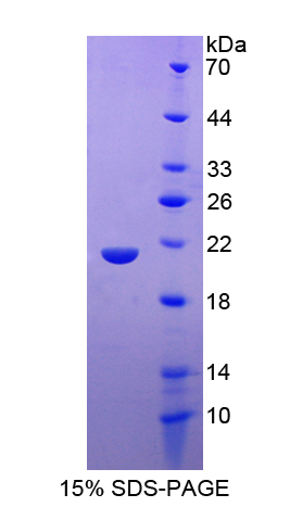 Recombinant Hemoglobin Beta (HBb)