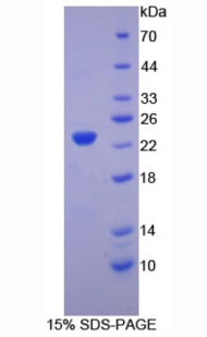 Recombinant Hemoglobin Beta (HBb)