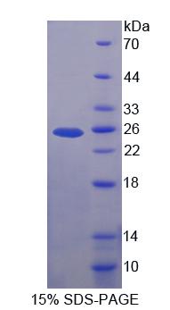 Recombinant Low Density Lipoprotein Receptor Related Protein 2 (LRP2)