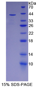 RPD177Hu01.jpg