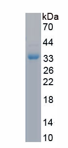 Recombinant Sequestosome 1 (SQSTM1)