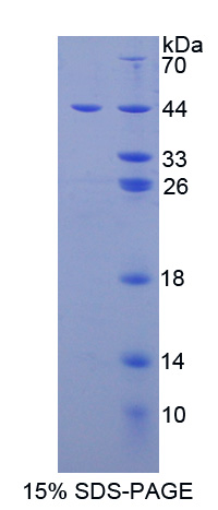 Recombinant Thyroid Stimulating Hormone Beta (TSHb)