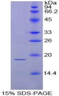 Recombinant Thyroid Stimulating Hormone Beta (TSHb)