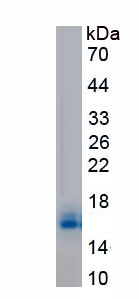 Recombinant Thyroid Stimulating Hormone Beta (TSHb)