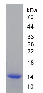 Recombinant Thyroid Stimulating Hormone Beta (TSHb)