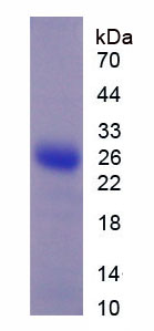 Recombinant Troponin I Type 1, Slow Skeletal (TNNI1)