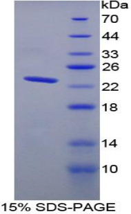 Recombinant Troponin I Type 2, Fast Skeletal (TNNI2)