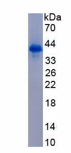 Recombinant Keratin 6A (KRT6A)