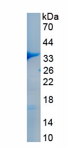 Recombinant Cytochrome b-245 Beta Polypeptide (CYBb)