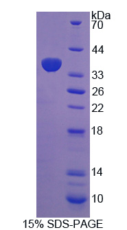 RPD310Hu01.jpg