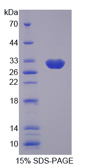 RPD320Hu01.jpg