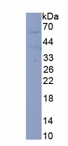 Recombinant Calcium/Calmodulin Dependent Protein Kinase II Alpha (CAMK2a)