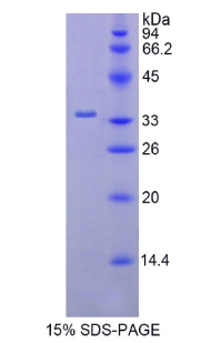 Recombinant Hexokinase 2 (HK2)