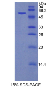 Recombinant Hexokinase 2 (HK2)