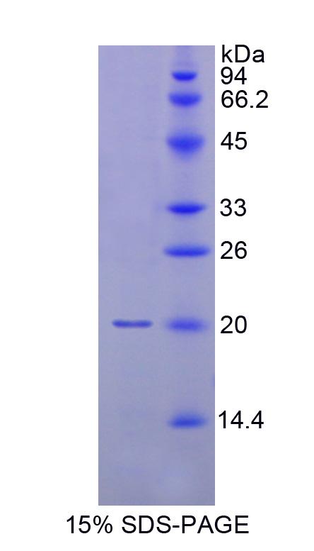 RPD452Hu01.jpg