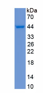 Recombinant Fucosidase Alpha L2, Plasma (FUCa2)