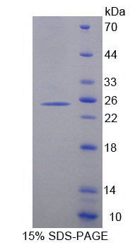 RPD540Hu01.jpg