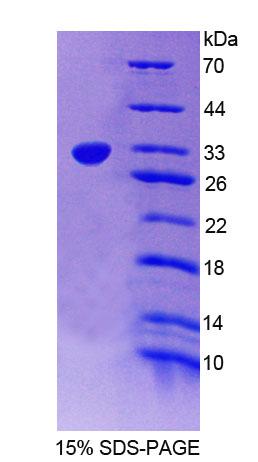 Recombinant Protein Tyrosine Phosphatase, Non Receptor Type 2 (PTPN2)