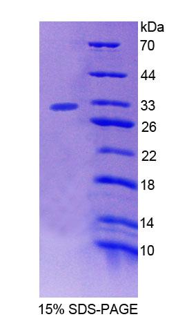 Recombinant Protein Tyrosine Phosphatase, Non Receptor Type 3 (PTPN3)